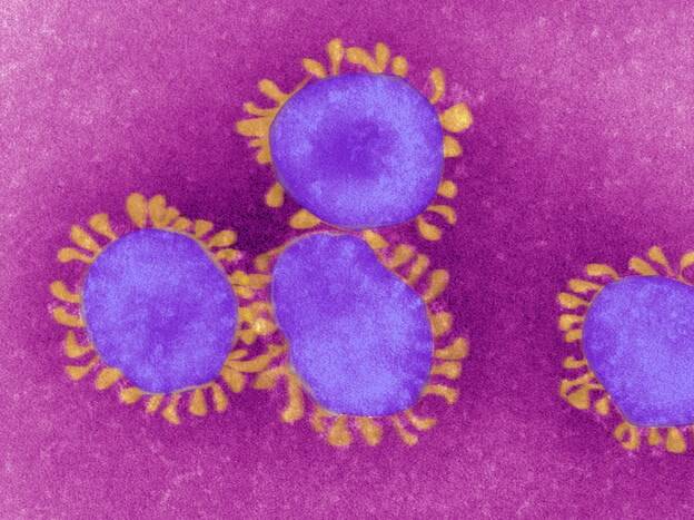 Coronavirus, 85 nuovi casi di Covid-19 in Toscana. In tutto 866 i contagi dall'inizio dell'emergenza.