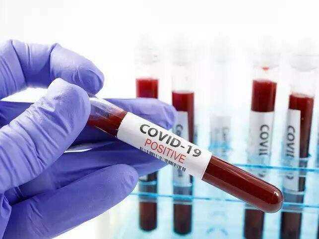 tamponi, covid, coronavirus